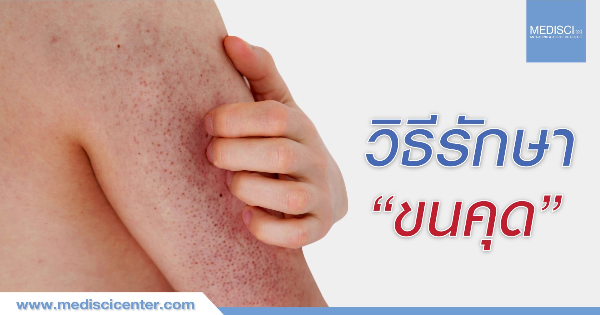 ขนคุด รักษา