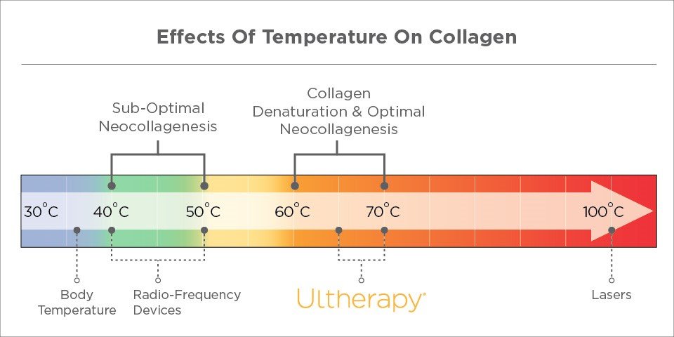 Ultherapy