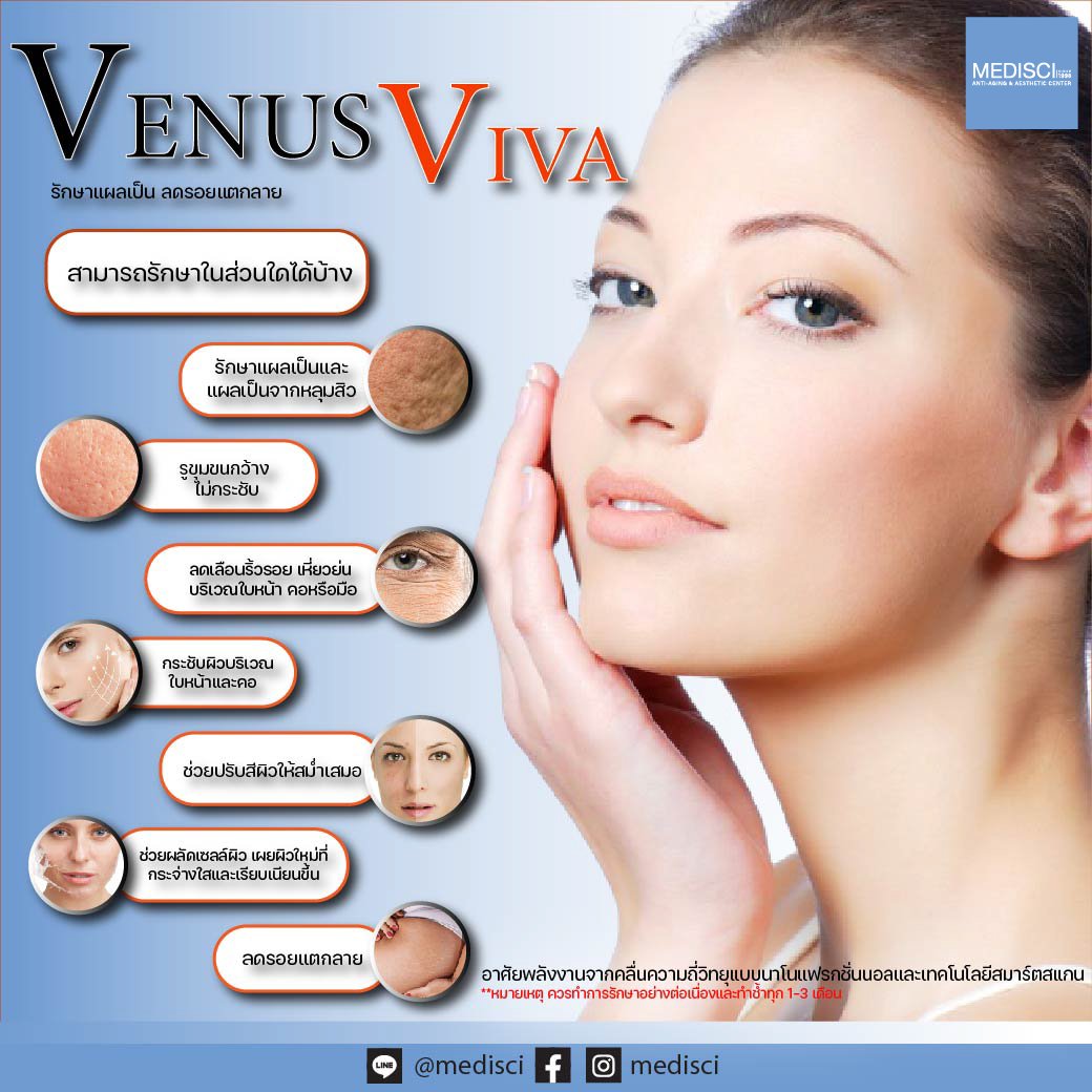 venus viva