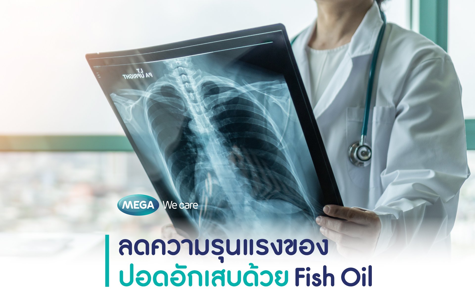 ลดความเสี่ยงรุนแรงของปอดอักเสบด้วย fish oil
