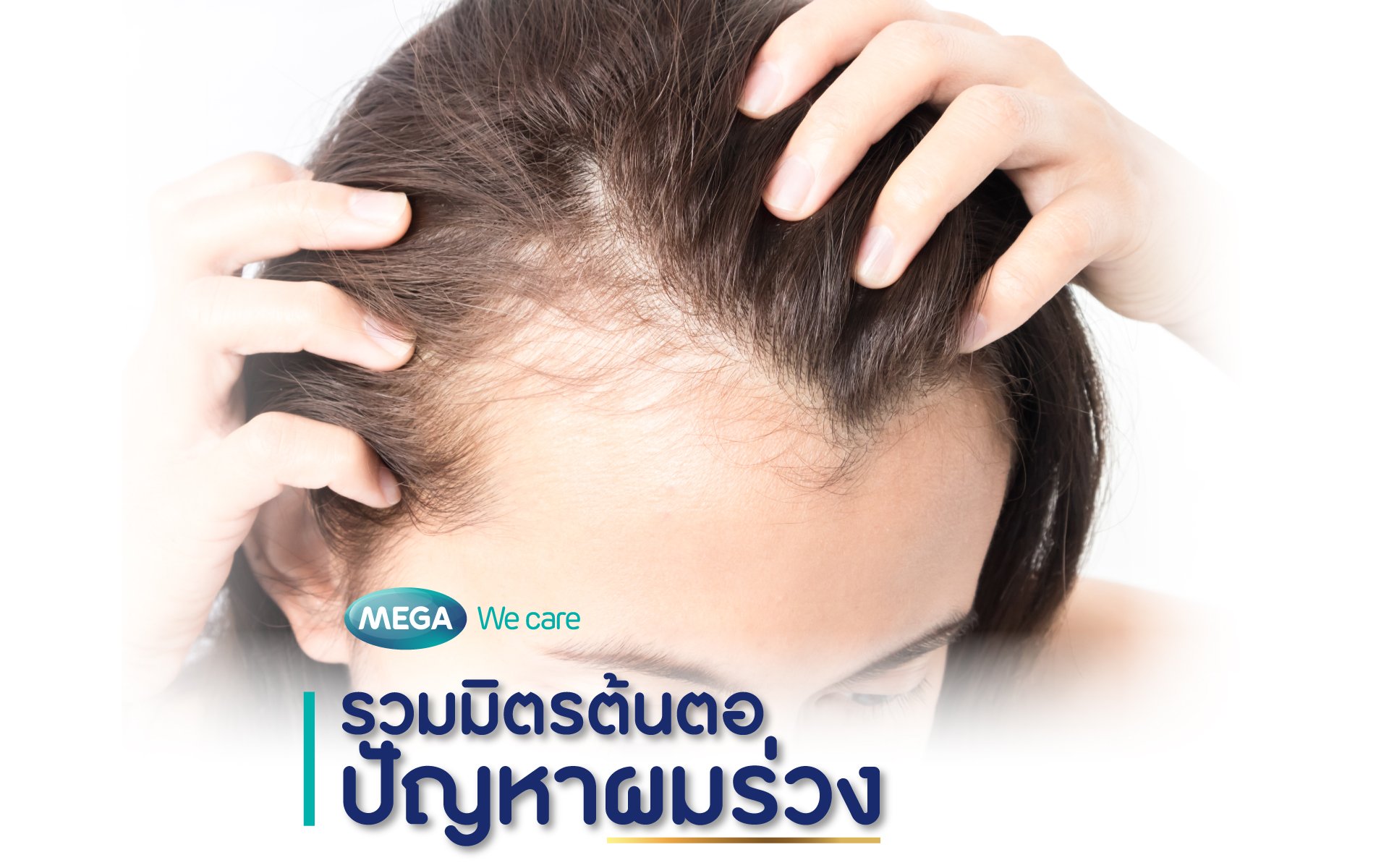 รวมมิตรต้นตอปัญหาผมร่วง - Megawecare