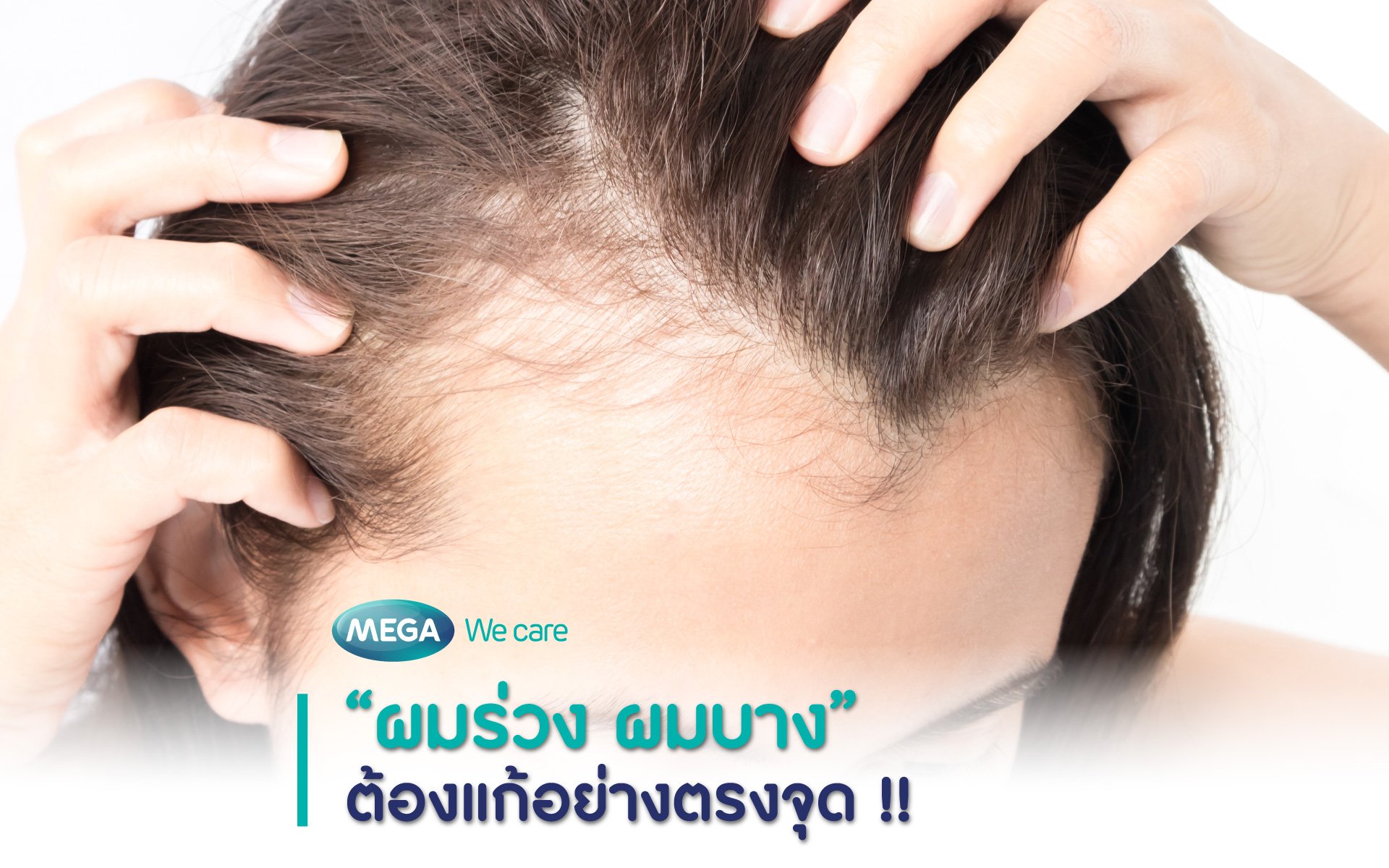 ผมร่วง ผมบางต้องทำอย่างไร - Mega We Care - Megawecare