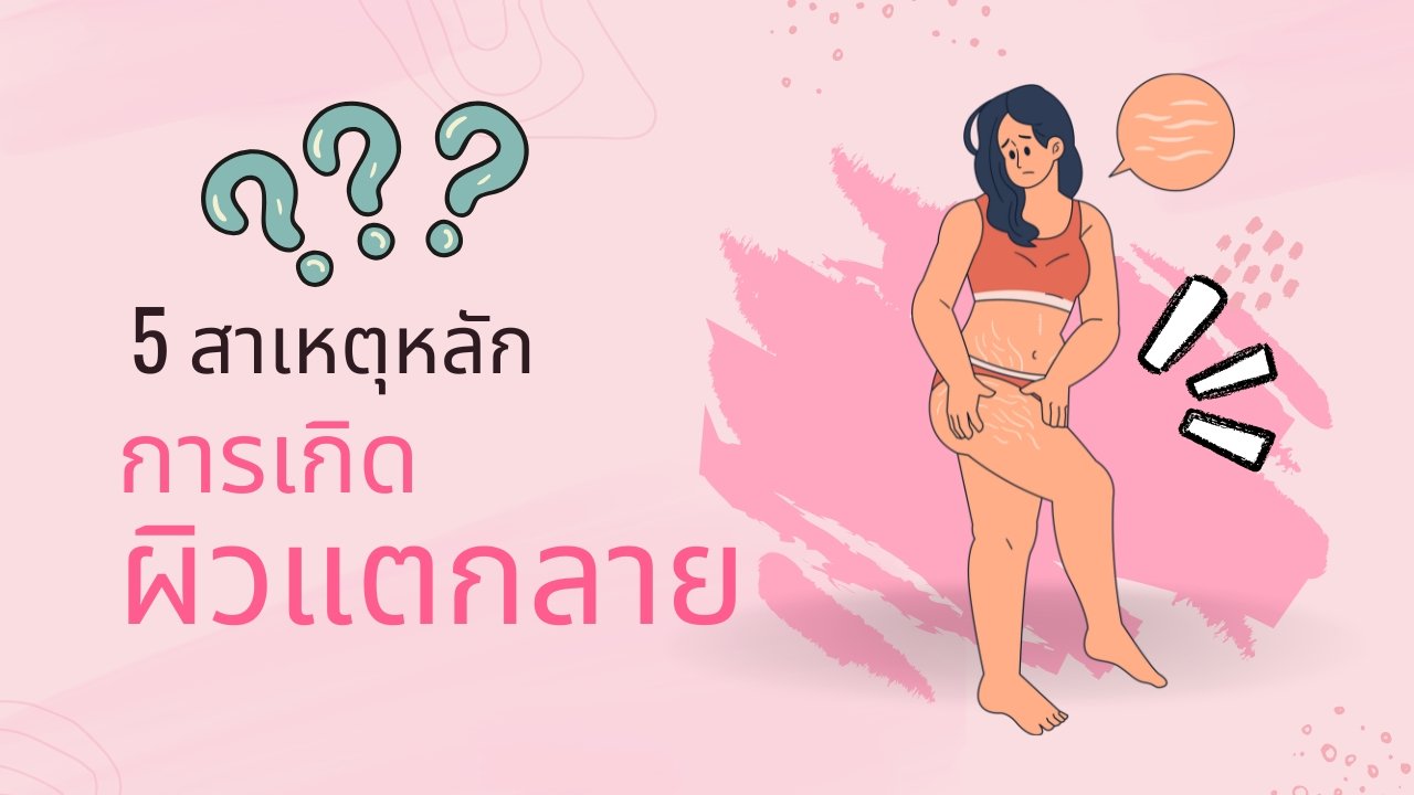 5 สาเหตุหลักที่ทำให้เกิดผิวแตกลาย พร้อมเคล็ดลับดูแลผิวให้กลับมาเรียบเนียน