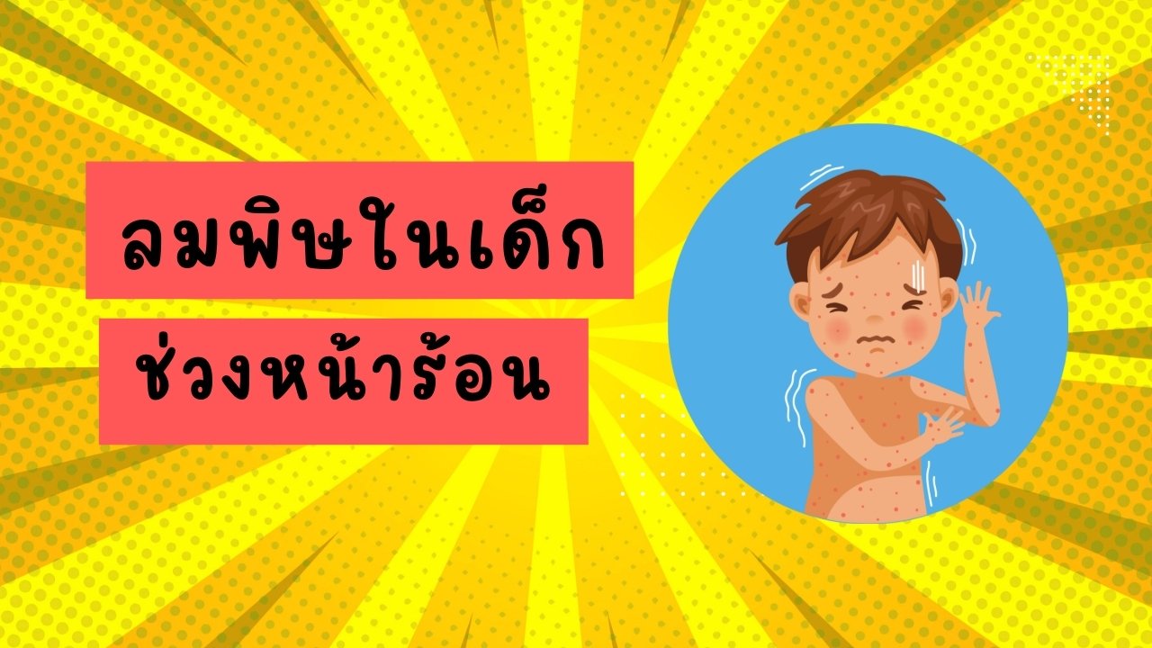 ลมพิษในเด็ก ช่วงหน้าร้อน