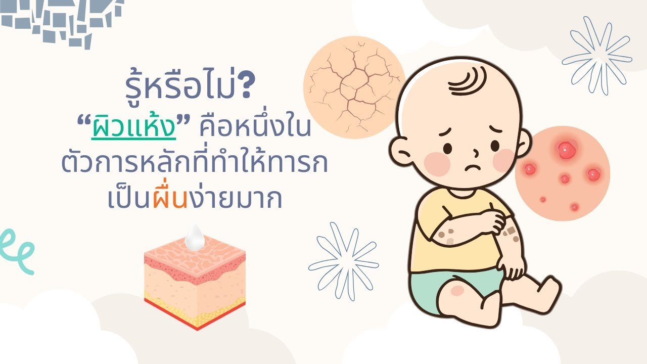 รู้หรือไม่ ผิวแห้งคือต้นเหตุร้ายที่ทำให้ทารกเป็นผื่นซ้ำซาก จัดการอย่างไรให้ผิวลูกกลับมาแข็งแรง