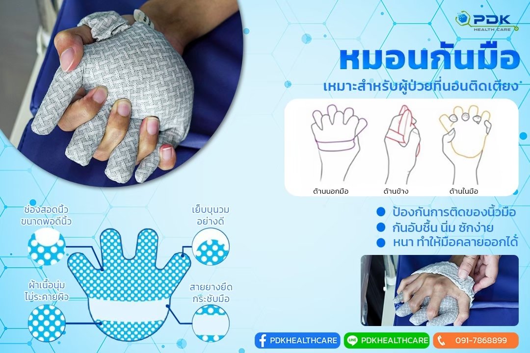 Anti-Grip Hand Cushion  An Essential Aid for Bedridden Patients Anti-Grip Hand Cushion  An Essential Aid for Bedridden Patients