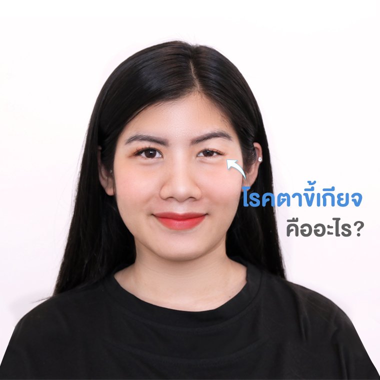 "  โรคตาขี้เกียจ  "