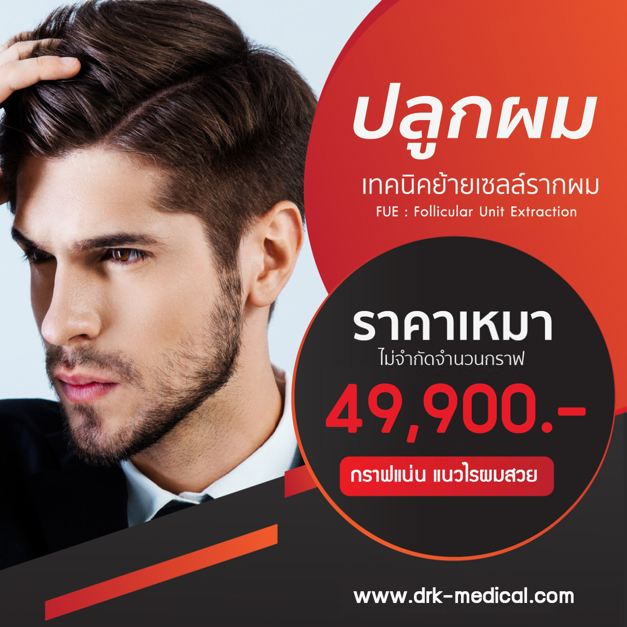 ปลูกผมถาวร FUE (Follicular Unit Extraction)