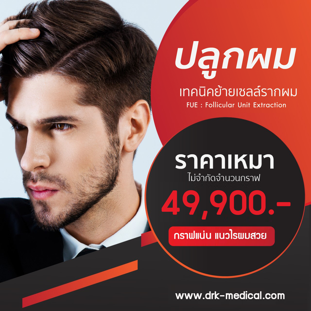 ปลูกผมถาวร FUE (Follicular Unit Extraction) ปลูกผมถาวร FUE (Follicular Unit Extraction)