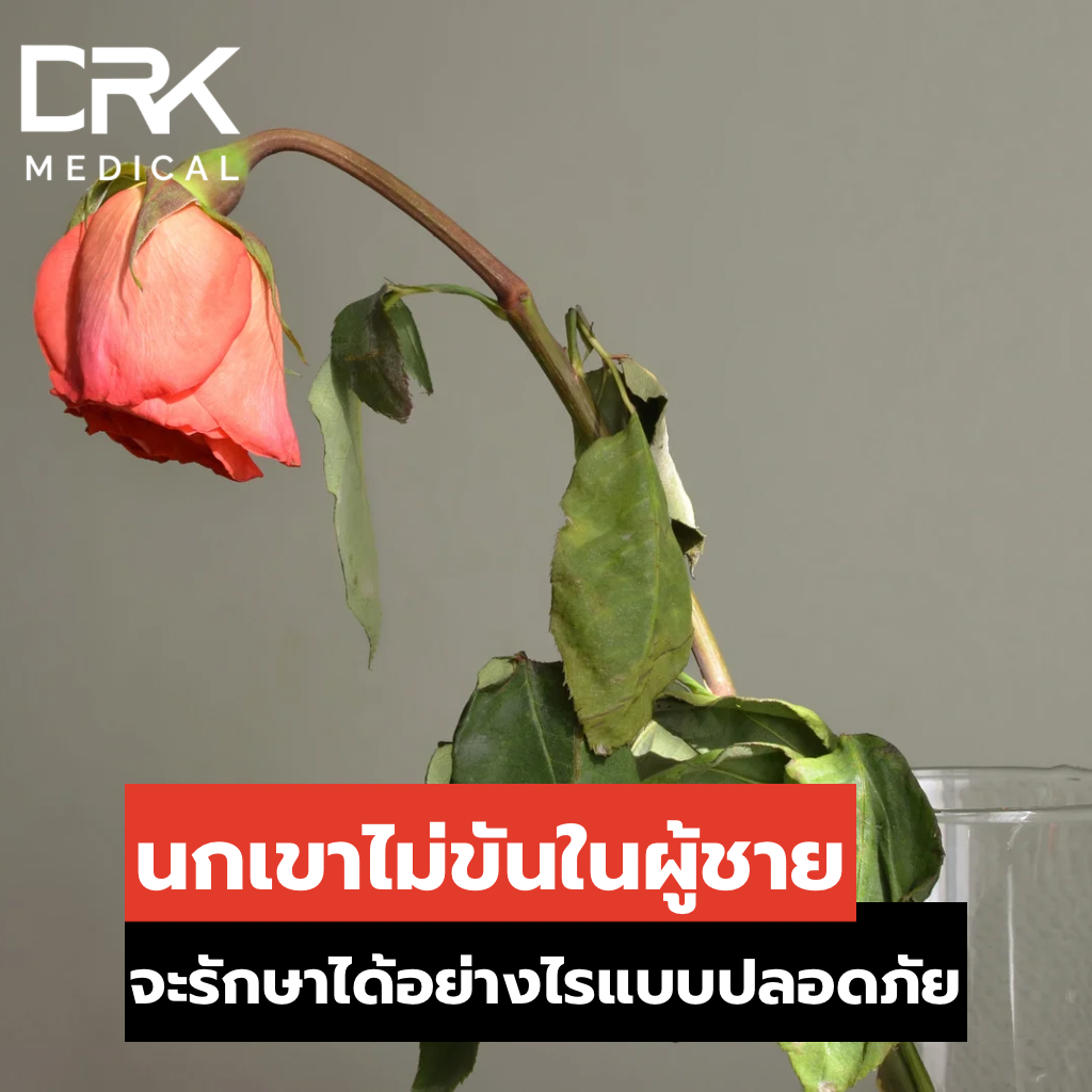 อวัยวะเพศชายไม่แข็งตัว (Erectile Dysfunction  ED) หรือ นกเขาไม่ขัน คืออะไร? อวัยวะเพศชายไม่แข็งตัว (Erectile Dysfunction  ED) หรือ นกเขาไม่ขัน คืออะไร?