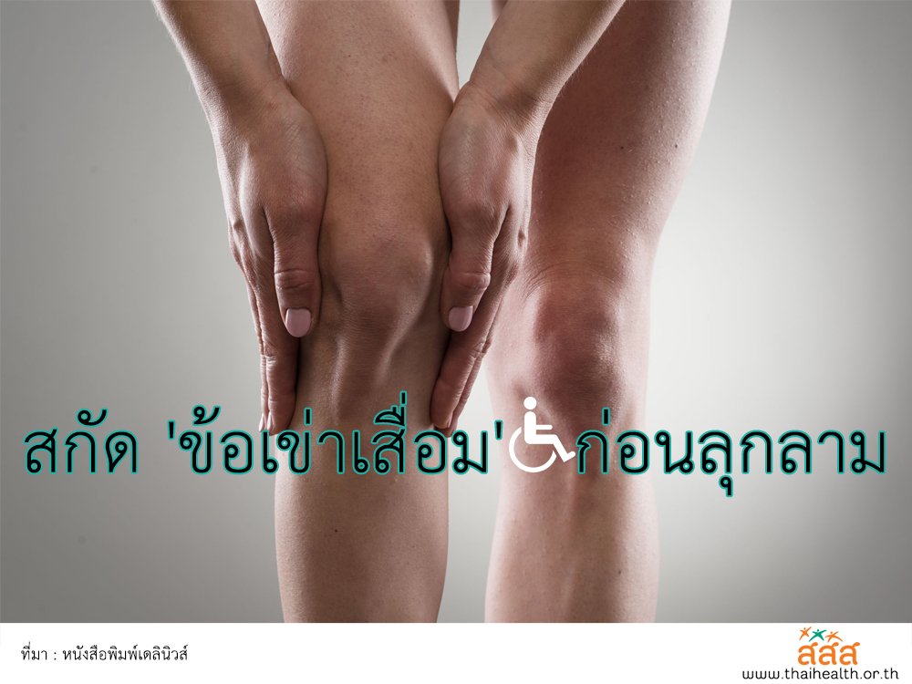 สกัด "ข้อเข่าเสื่อม" ก่อนลุกลาม