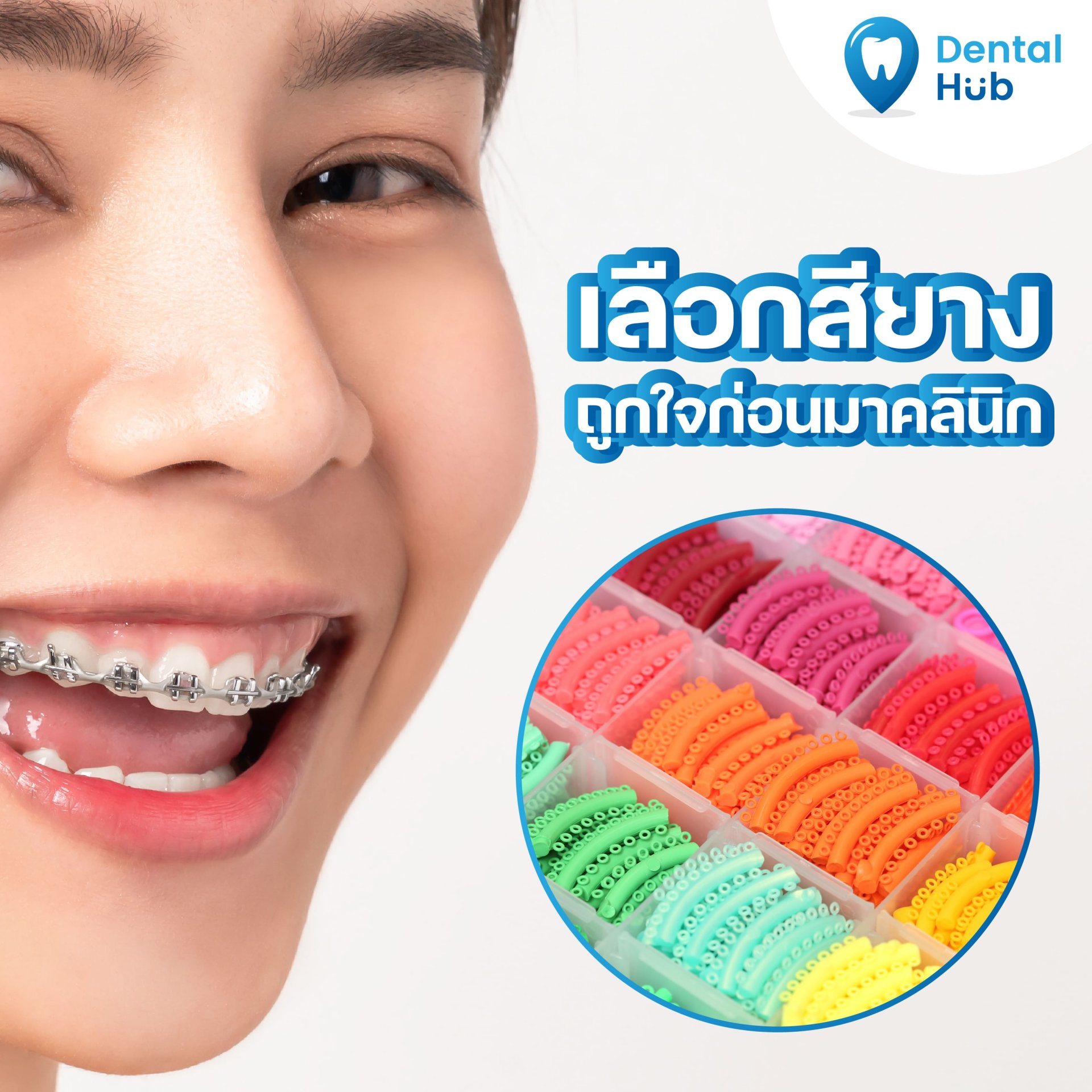สียางจัดฟัน - dentalhubclinic สียางจัดฟัน - Dentalhubclinic