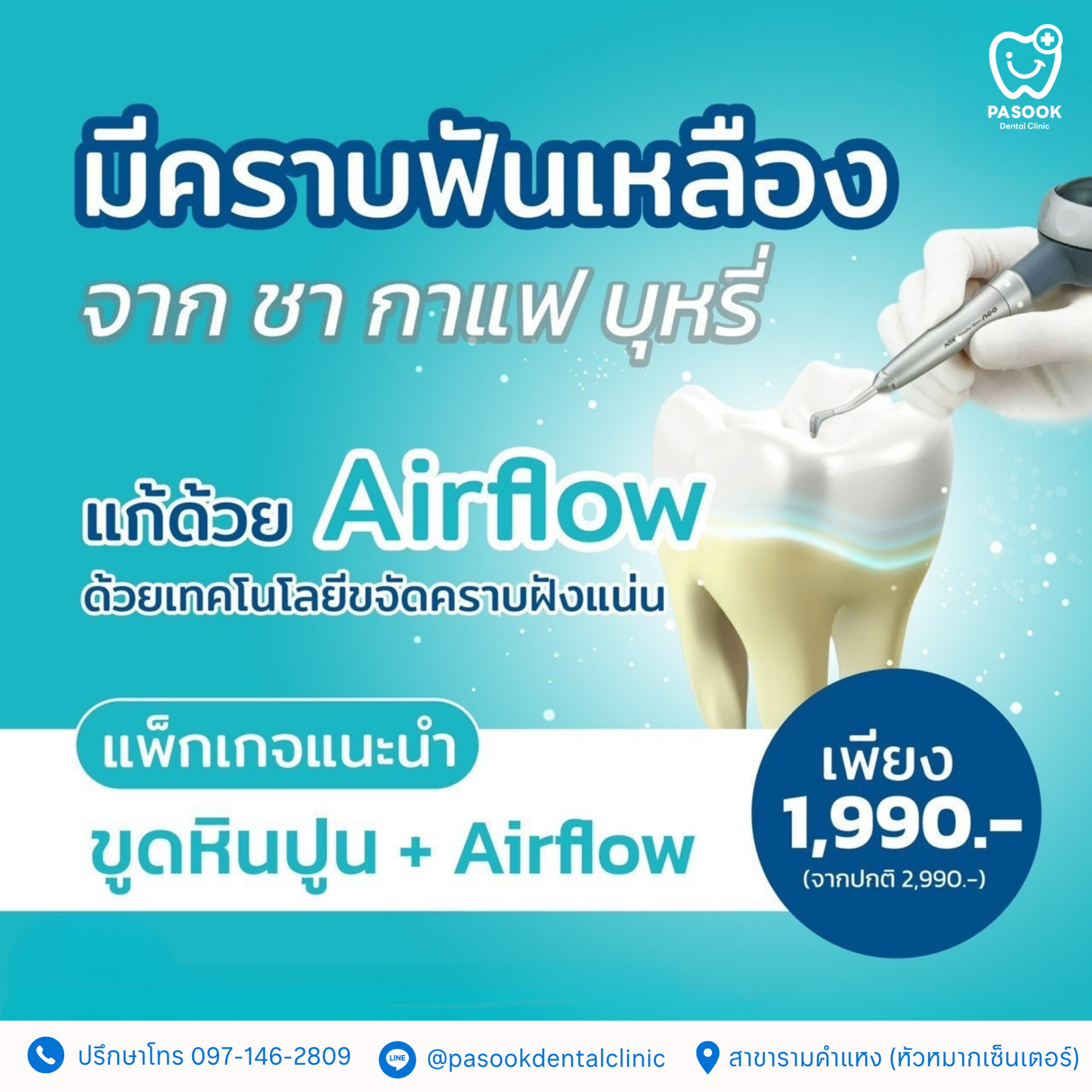 ขูดหินปูน
