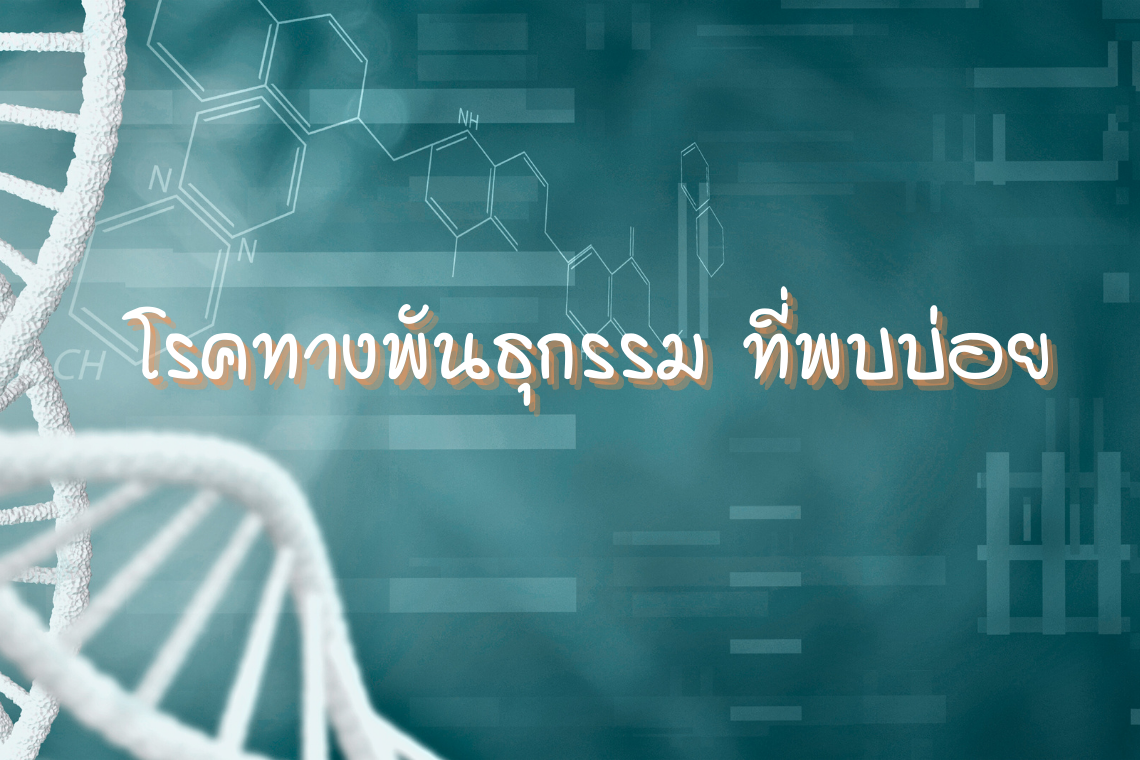 โรคทางพันธุกรรม ที่พบบ่อย โรคทางพันธุกรรม ที่พบบ่อย