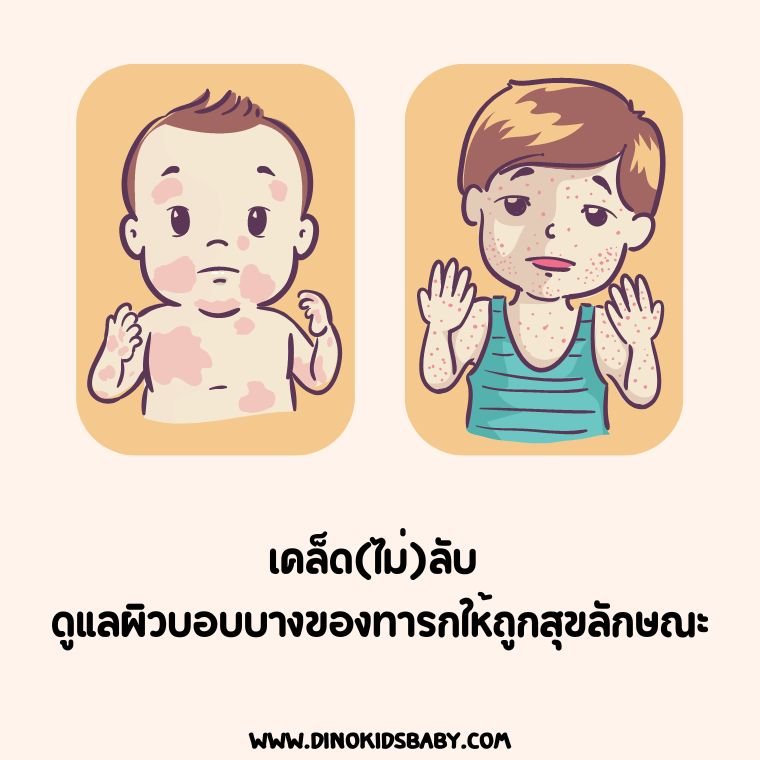 เคล็ด(ไม่)ลับ ดูแลผิวบอบบางของทารกให้ถูกสุขลักษณะ เคล็ด(ไม่)ลับ ดูแลผิวบอบบางของทารกให้ถูกสุขลักษณะ