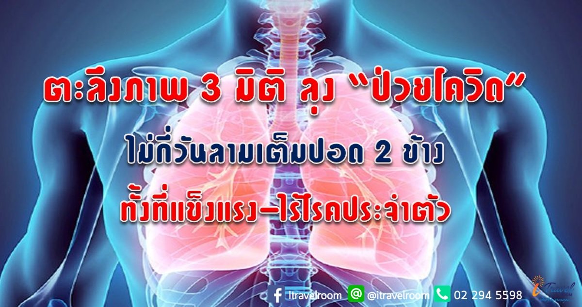ตะลึงภาพ 3 มิติ ลุง “ป่วยโควิด” ไม่กี่วันลามเต็มปอด 2 ข้าง ทั้งที่แข็งแรง-ไร้โรคประจำตัว  ตะลึงภาพ 3 มิติ ลุง “ป่วยโควิด” ไม่กี่วันลามเต็มปอด 2 ข้าง ทั้งที่แข็งแรง-ไร้โรคประจำตัว