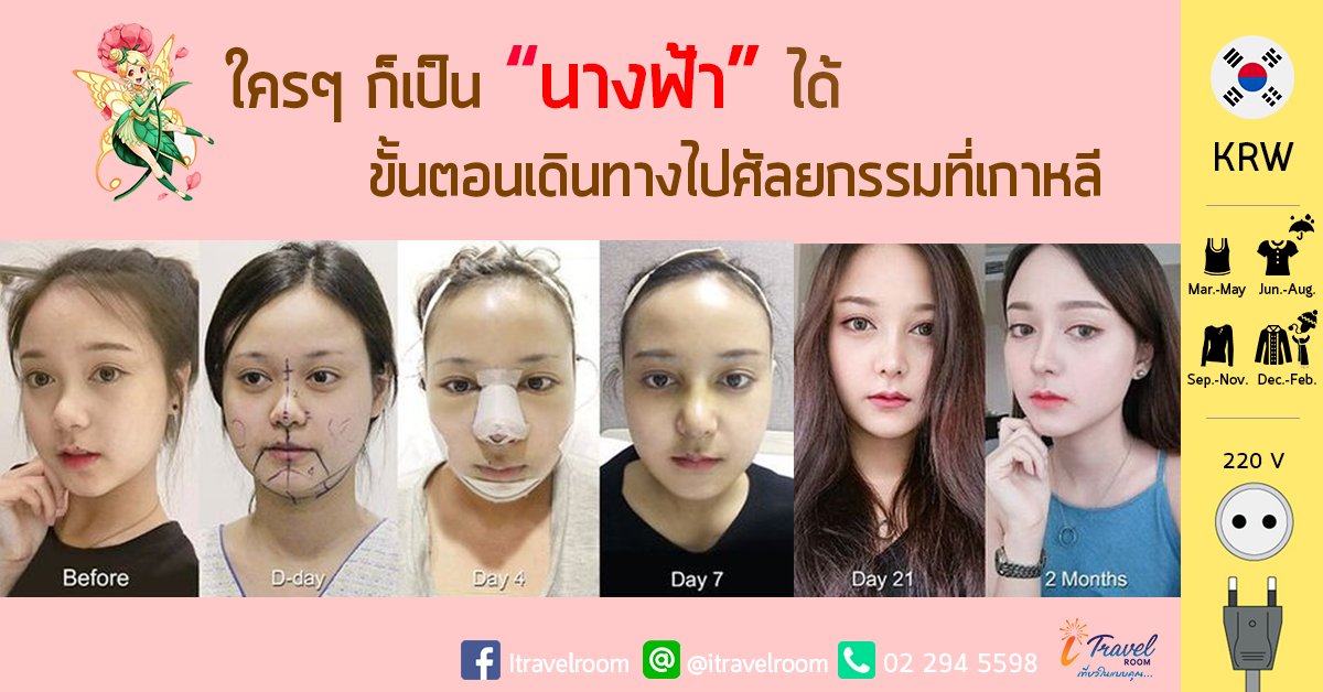 ขั้นตอนเดินทางไปศัลยกรรมที่เกาหลี