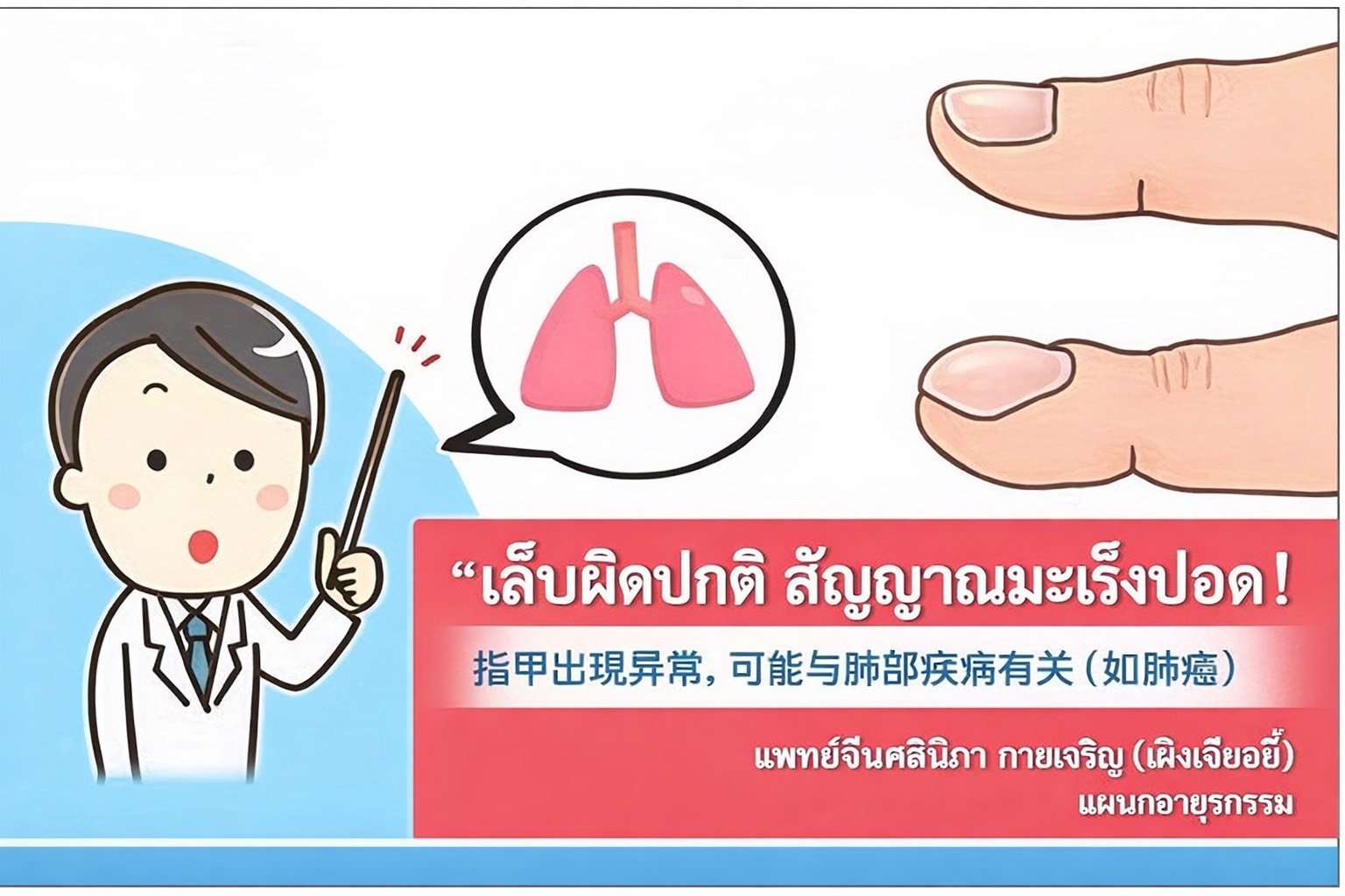 冯解语中医师讲解指甲异常，可能是肺癌信号!