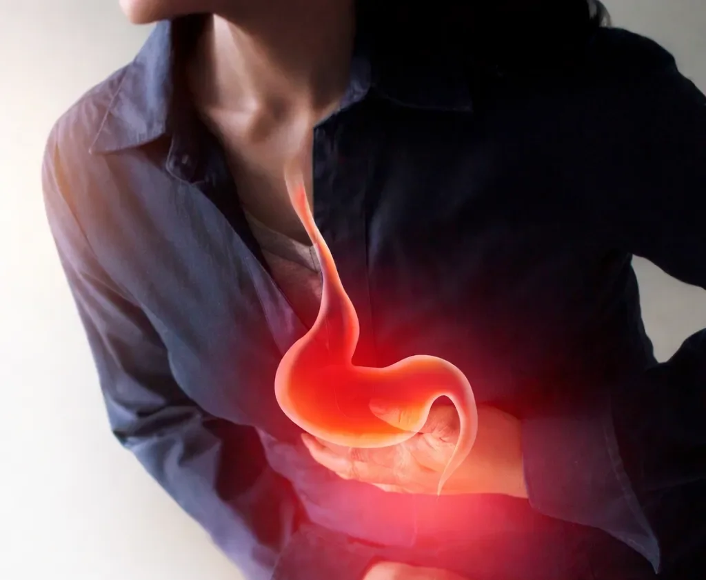 毕雅玛中医师讲解针灸治疗肝气犯胃及胃食管反流病的临床案例