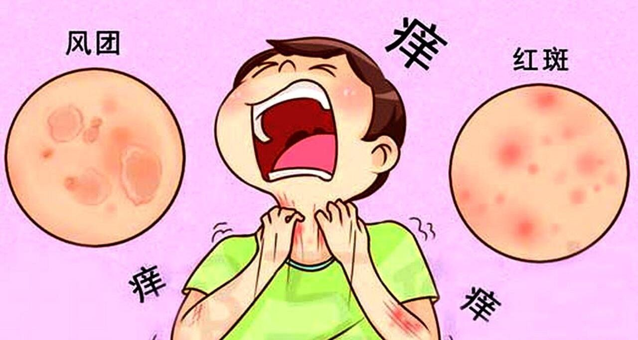 风邪与瘙痒的治病特点！曾彩瑛资深中医师治疗解析
