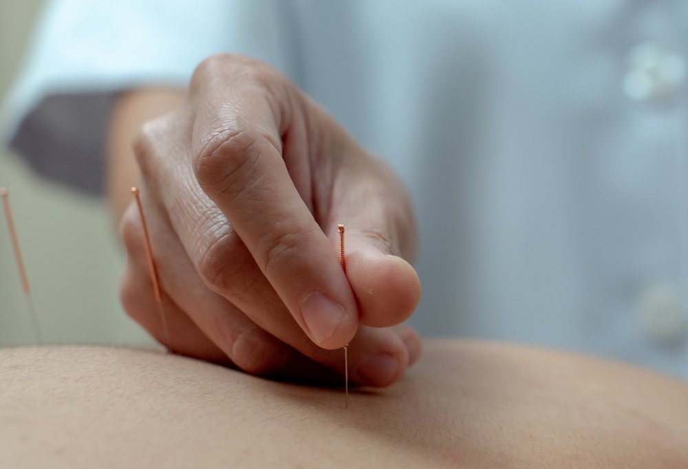 温珍慧资深中医师讲解针灸治疗偏头痛的优势