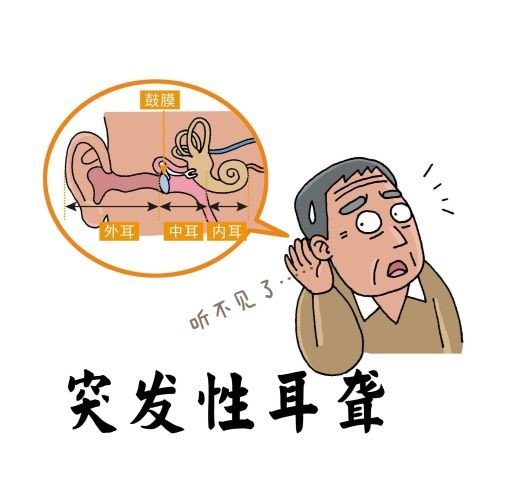 针灸治疗突发性耳聋,毕雅玛中医师来解答! 针灸治疗突发性耳聋,毕雅玛中医师来解答!