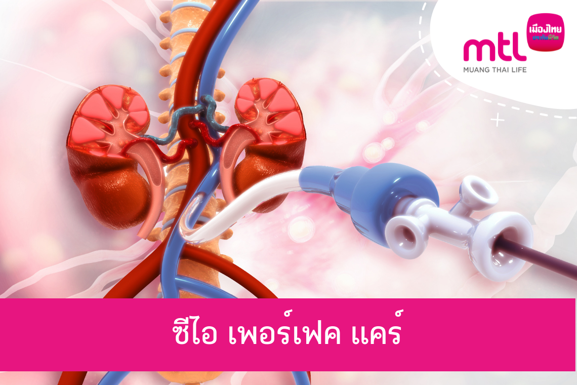 ซีไอ เพอร์เฟค แคร์ (CI Prefect Care)