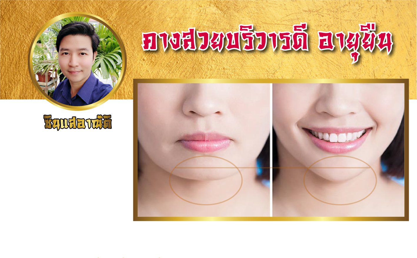คางสวย บริวารดี อายุยืน คางสวย บริวารดี อายุยืน