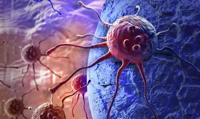 Cancer and Tumor What Is Cancer?