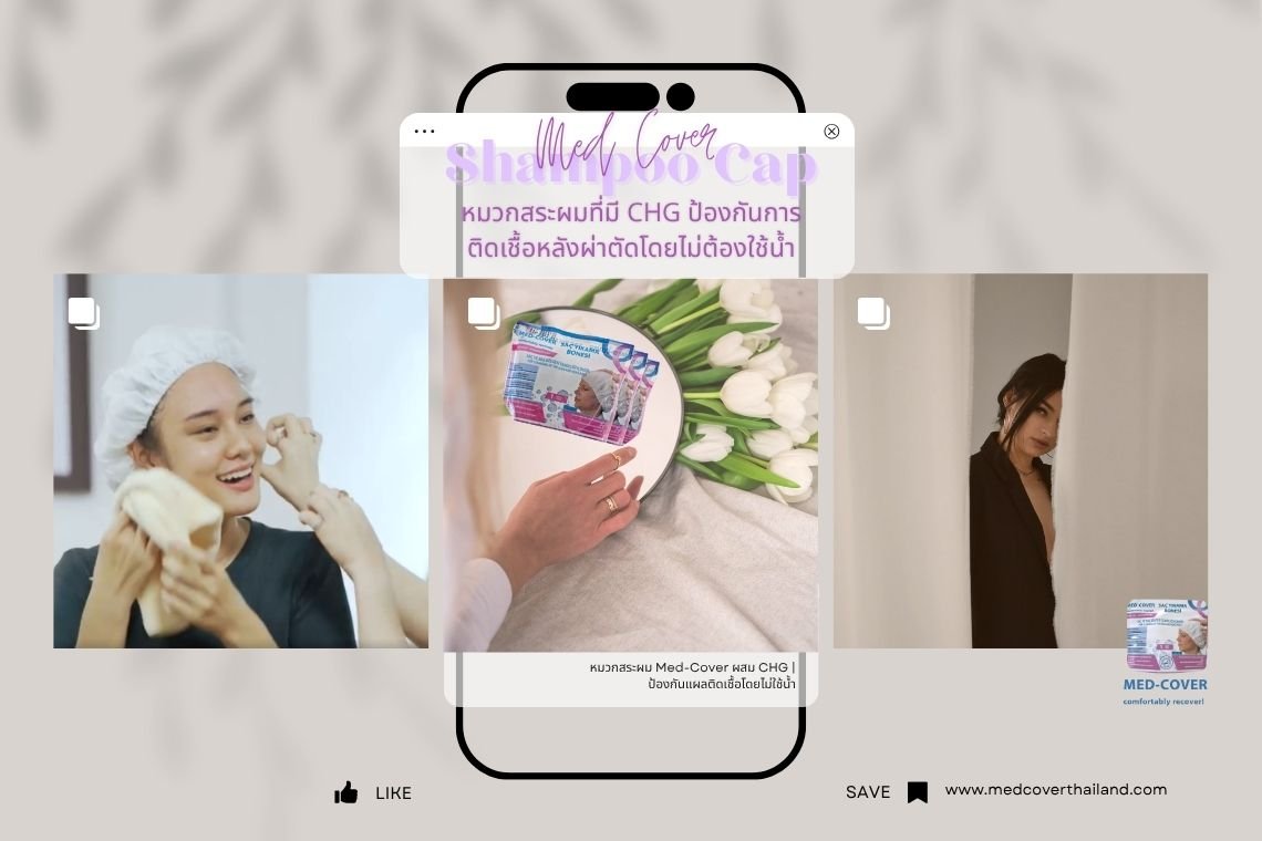 หมวกสระผม Med-Cover พร้อมคลอร์เฮกซิดีน: ปลอดภัย สะดวก ลดความเสี่ยงติดเชื้อ