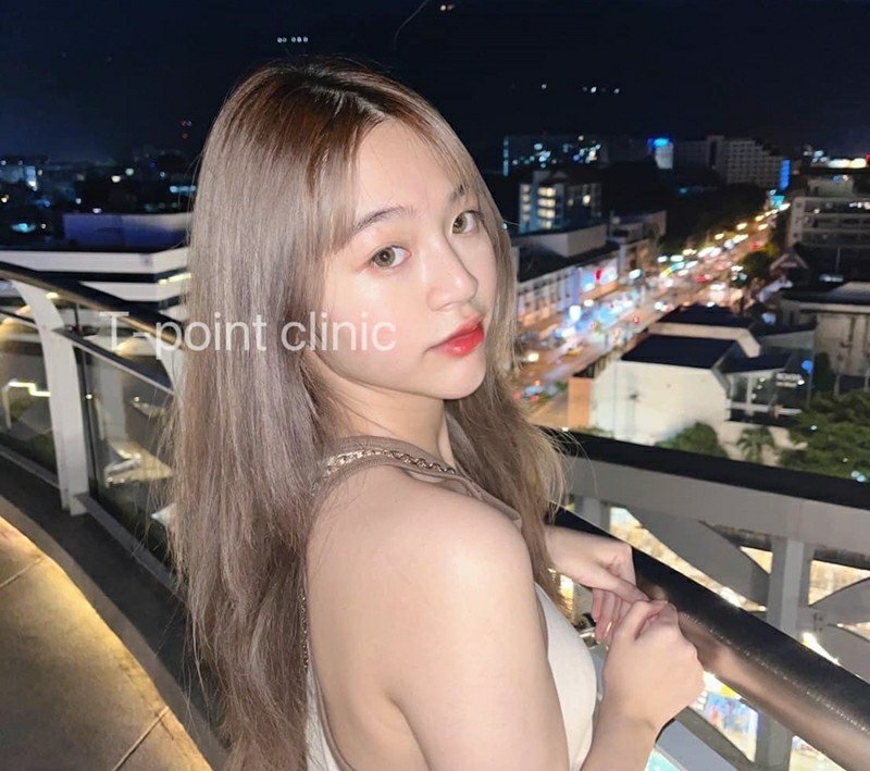 เรื่องน่ารู้ในการเตรียมตัวทั้งก่อนและหลังจาก เสริมจมูก เชียงใหม่ เรื่องน่ารู้ในการเตรียมตัวทั้งก่อนและหลังจาก เสริมจมูก เชียงใหม่