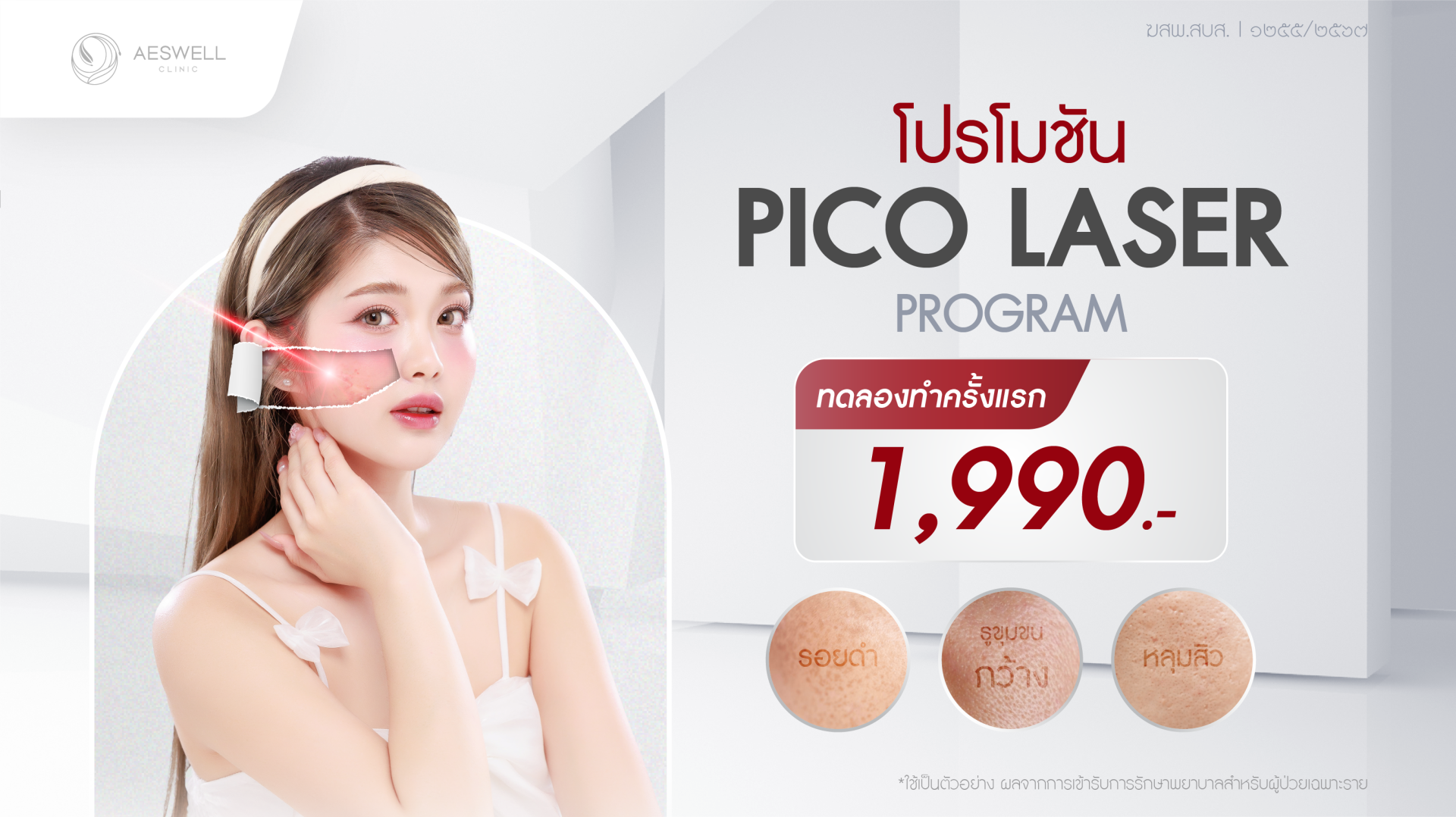 โปรโมชันรักษาสิว โปรโมชันรักษาสิว