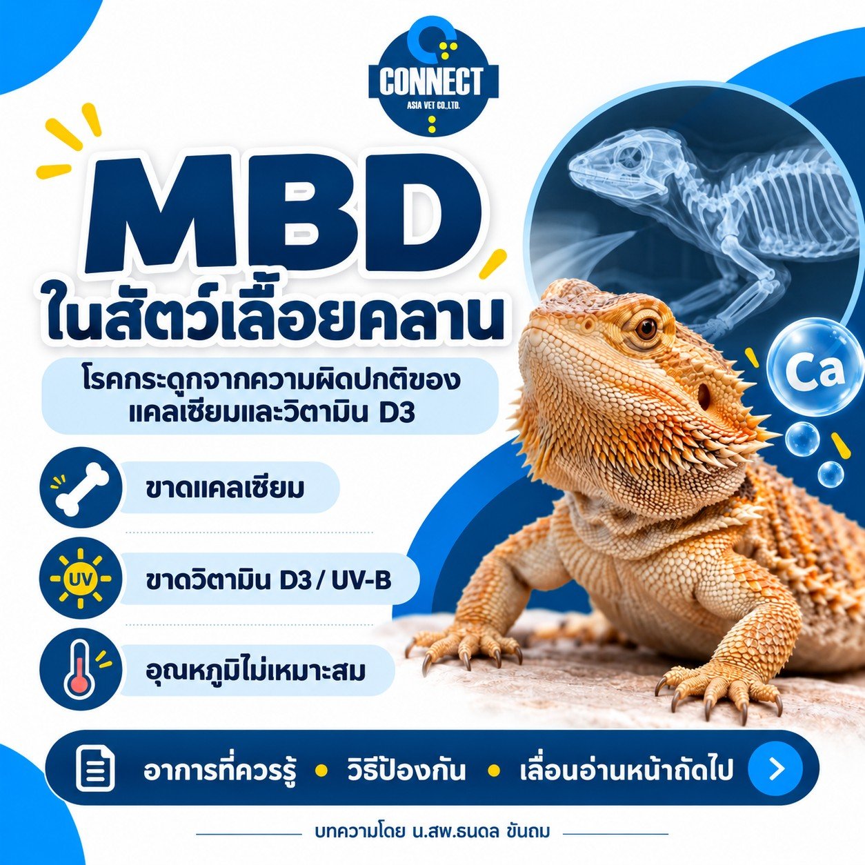 Metabolic Bone Disease (MBD)
