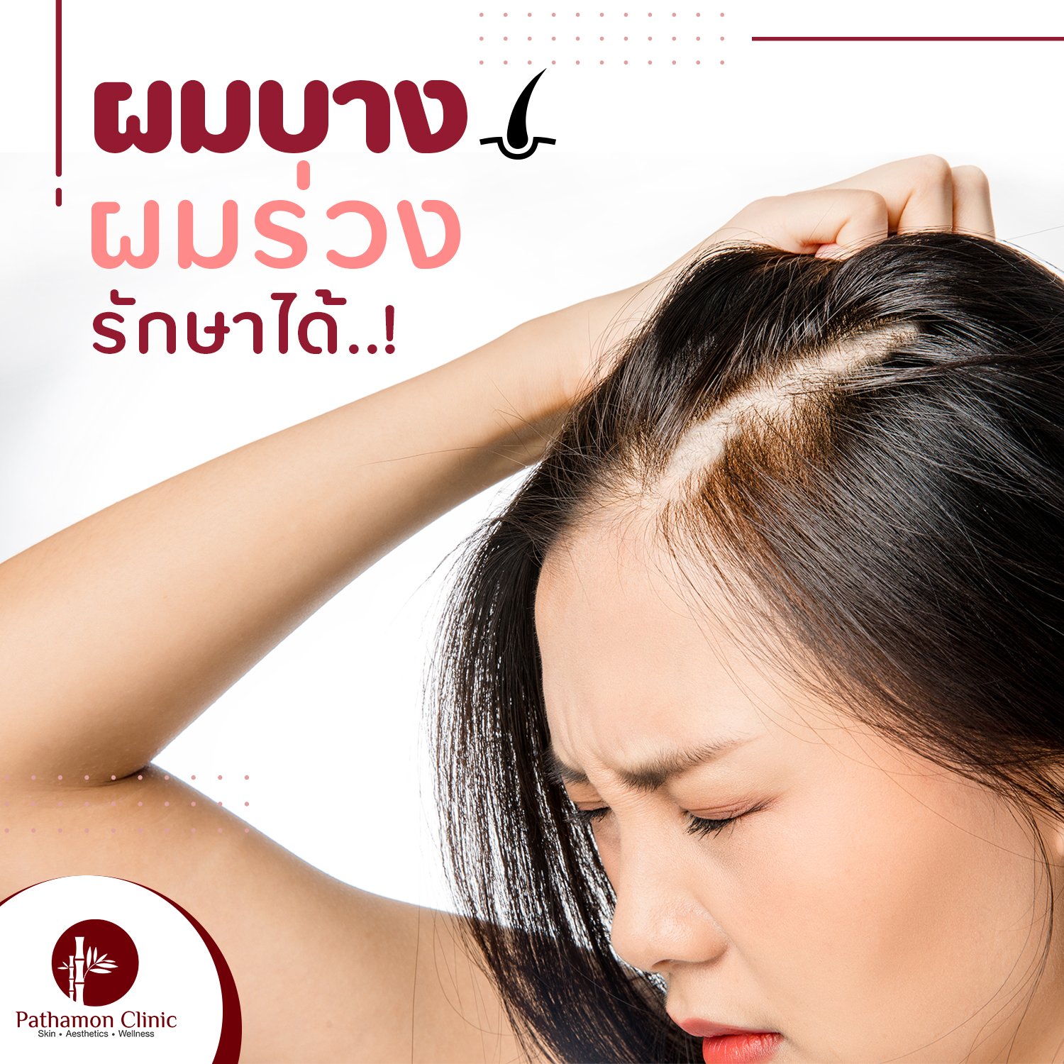 รักษาผมร่วงผมบาง - Pathamonclinic