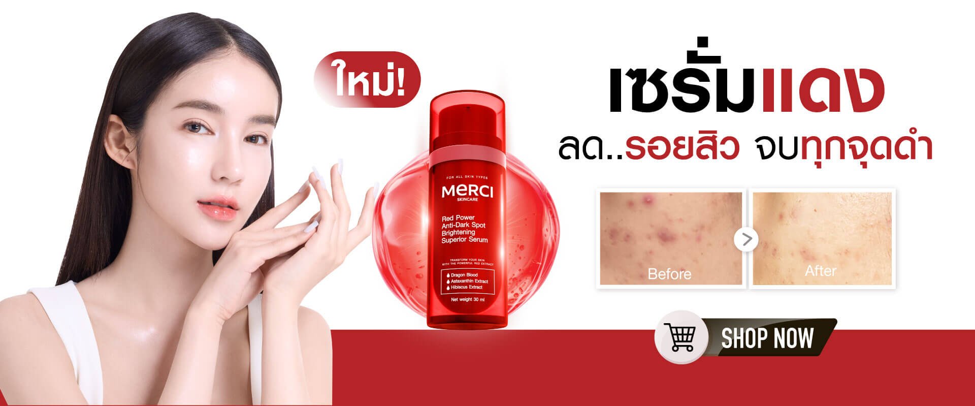 เมอร์ซี่ เซรั่มแดง ลดรอยสิว ลดจุดด่างดำ