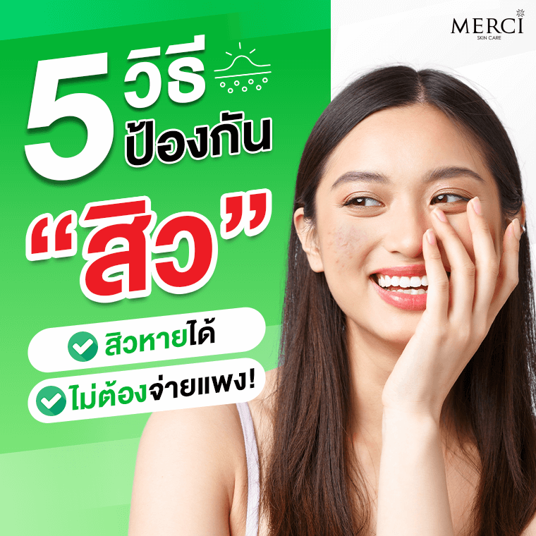 5 วิธีป้องกันสิว สิวหายได้ ไม่ต้องจ่ายแพง