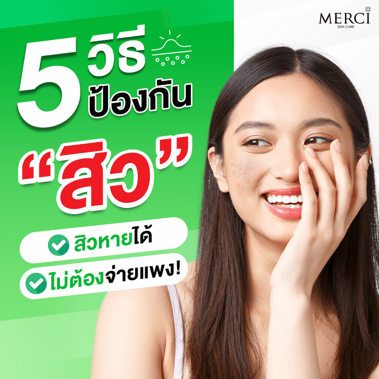 5 วิธีป้องกันสิว สิวหายได้ ไม่ต้องจ่ายแพง 5 วิธีป้องกันสิว สิวหายได้ ไม่ต้องจ่ายแพง