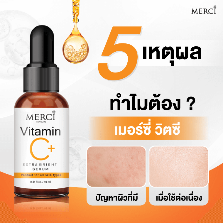 5 เหตุผล ทำไมต้องใช้ “เมอร์ซี่ วิตซี” 5 เหตุผล ทำไมต้องใช้ “เมอร์ซี่ วิตซี”