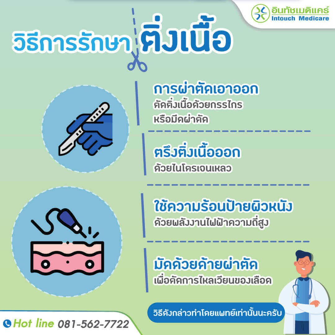 how-to-treat-skin-tags วิธีรักษาติ่งเนื้อ
