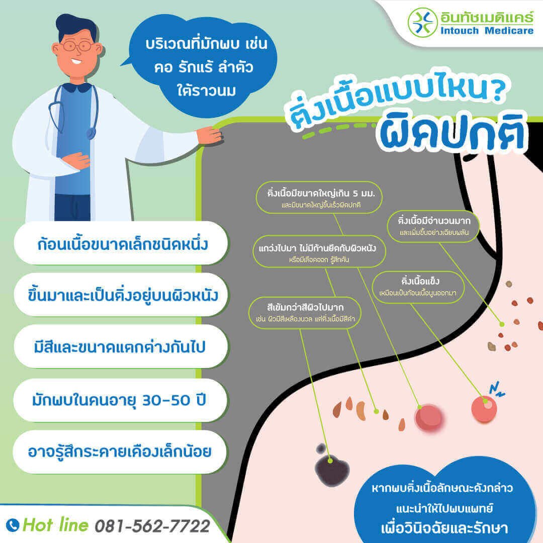 skin-tags ติ่งเนื้อ