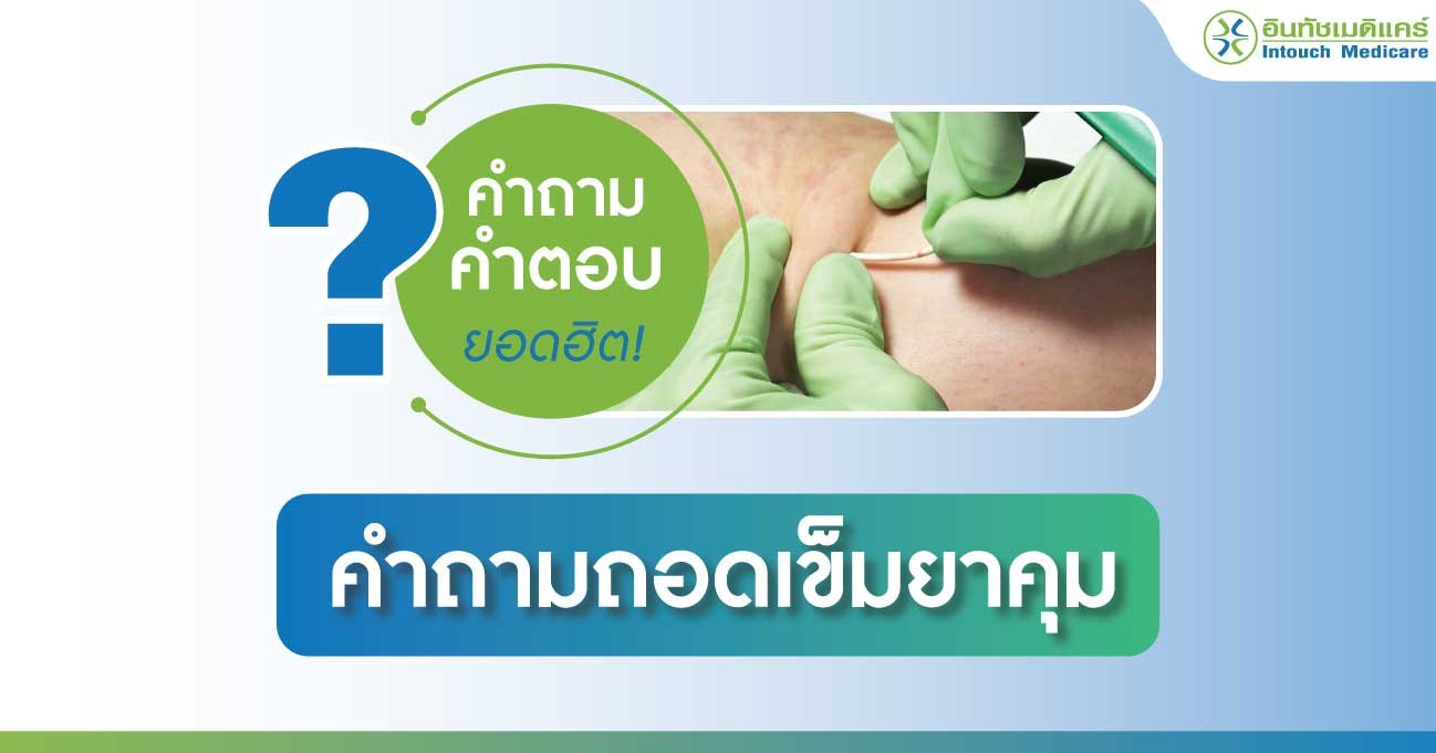 คำถามถอดเข็มยาคุมที่พบบ่อย คำถามถอดเข็มยาคุมที่พบบ่อย