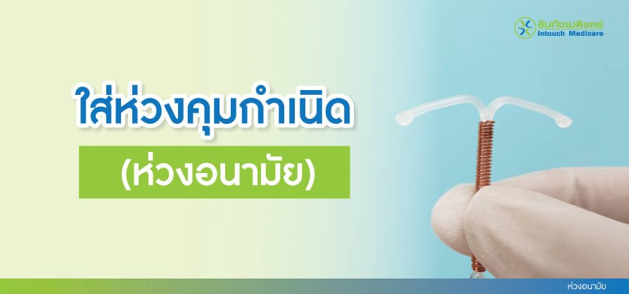 Intrauterine device ห่วงอนามัย