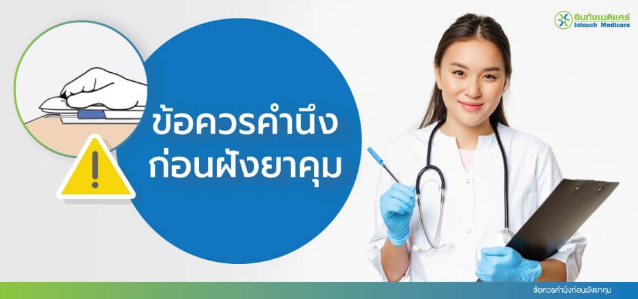 ข้อควรคำนึงก่อนฝังยาคุม