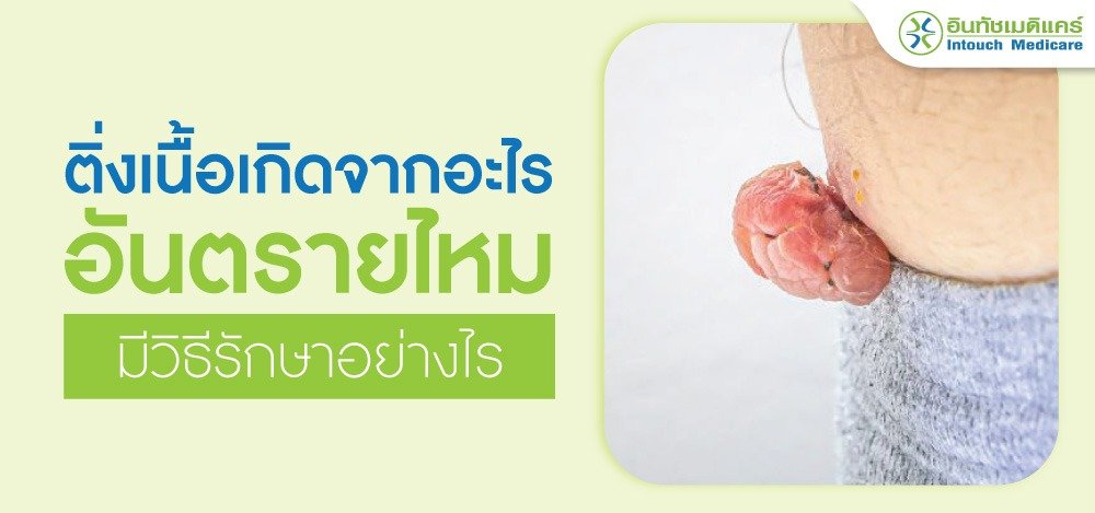 ติ่งเนื้อเกิดจากอะไร