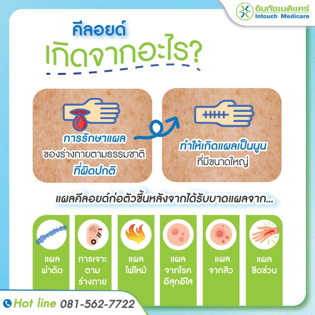 คีลอยด์ คีลอยด์ เกิดจากอะไร