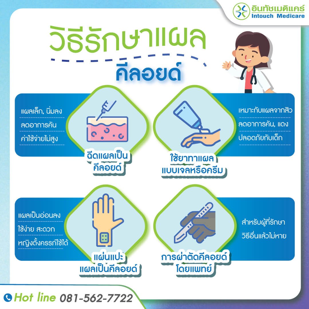 คีลอยด์ การรักษาคีลอยด์