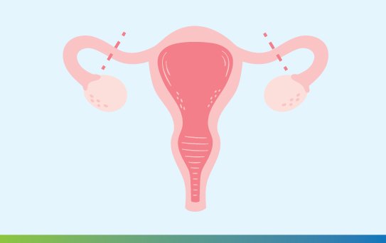 ทำหมัน การทำหมัน