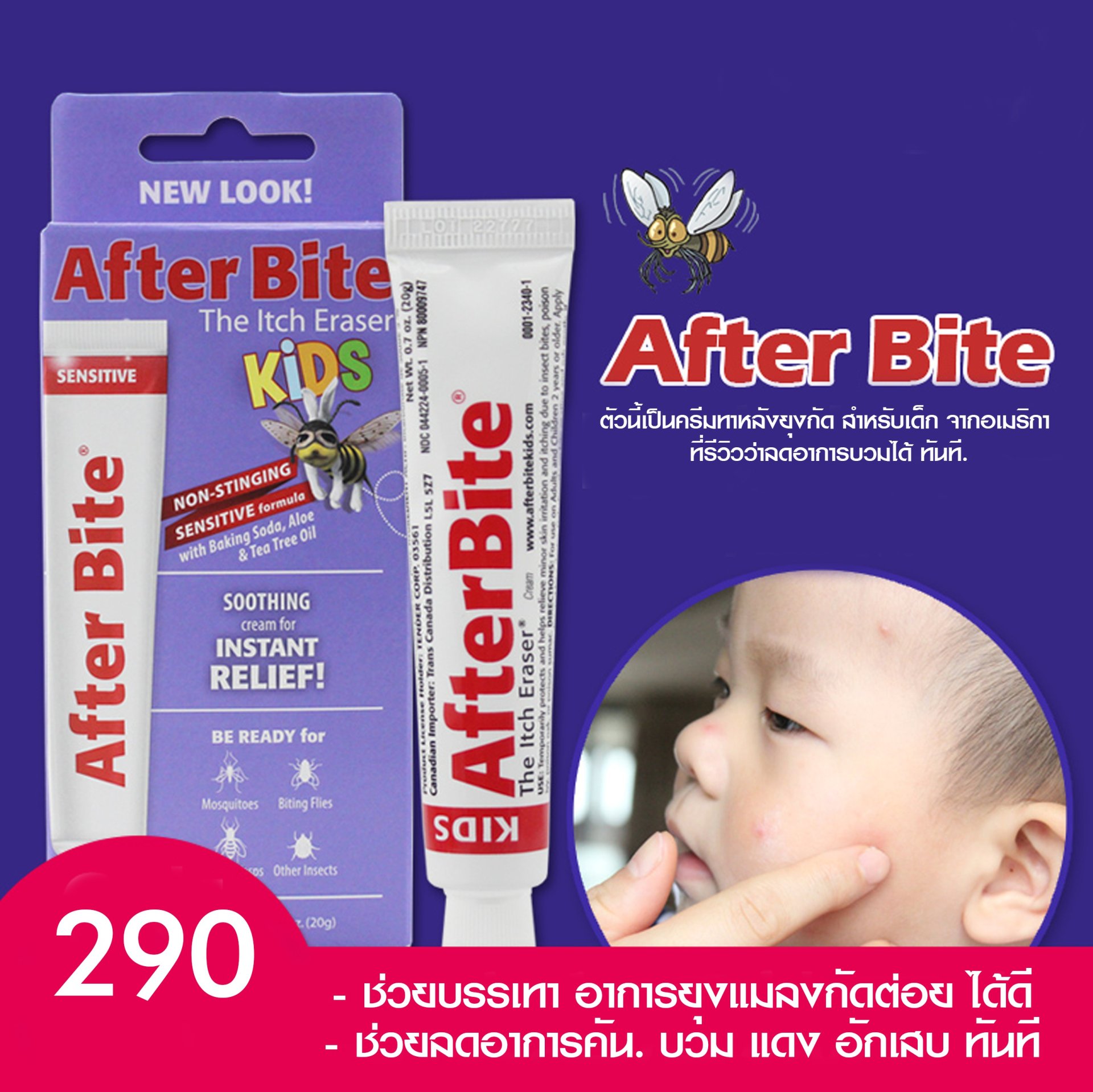 ครีมทาหลังยุงกัด After Bite