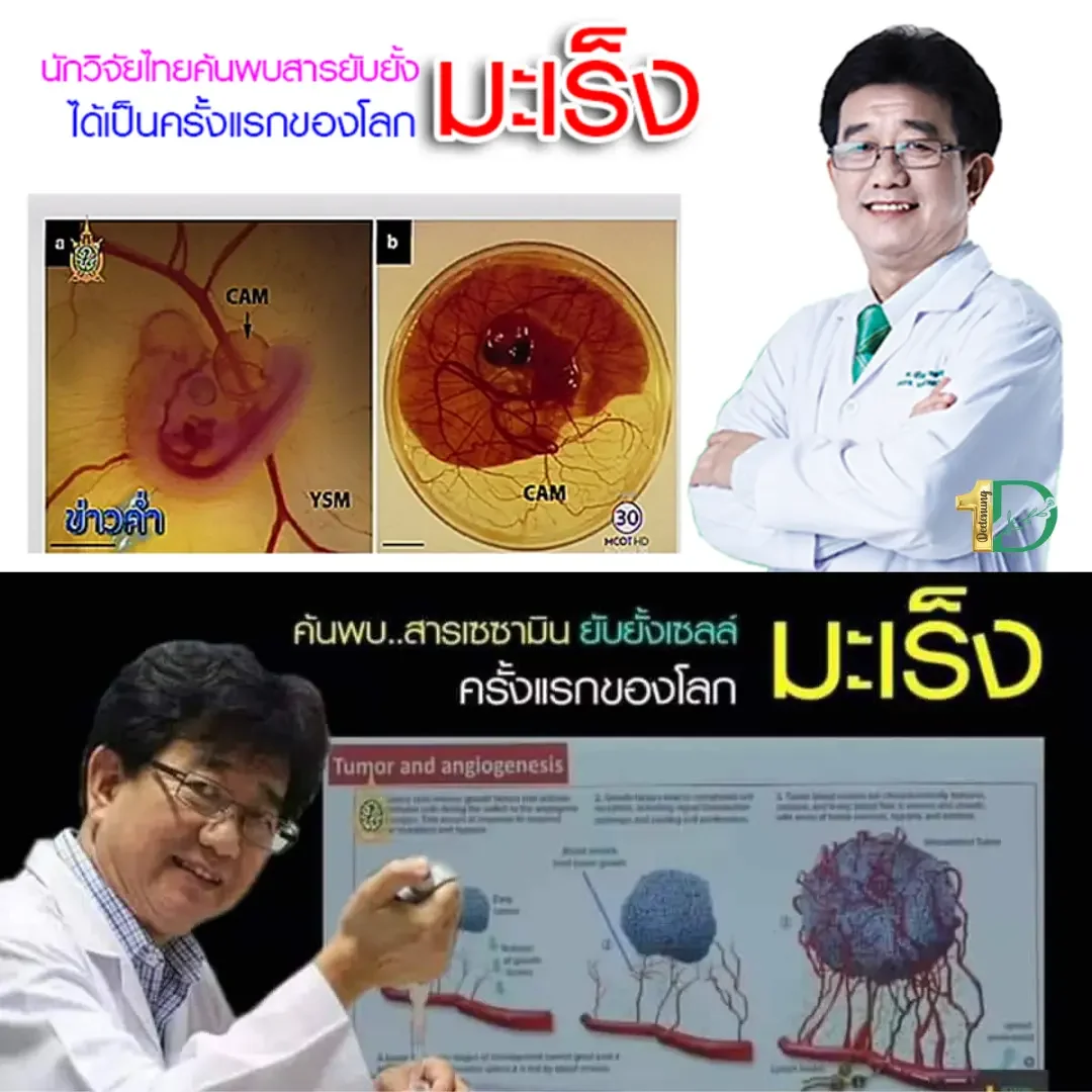 โรคมะเร็ง