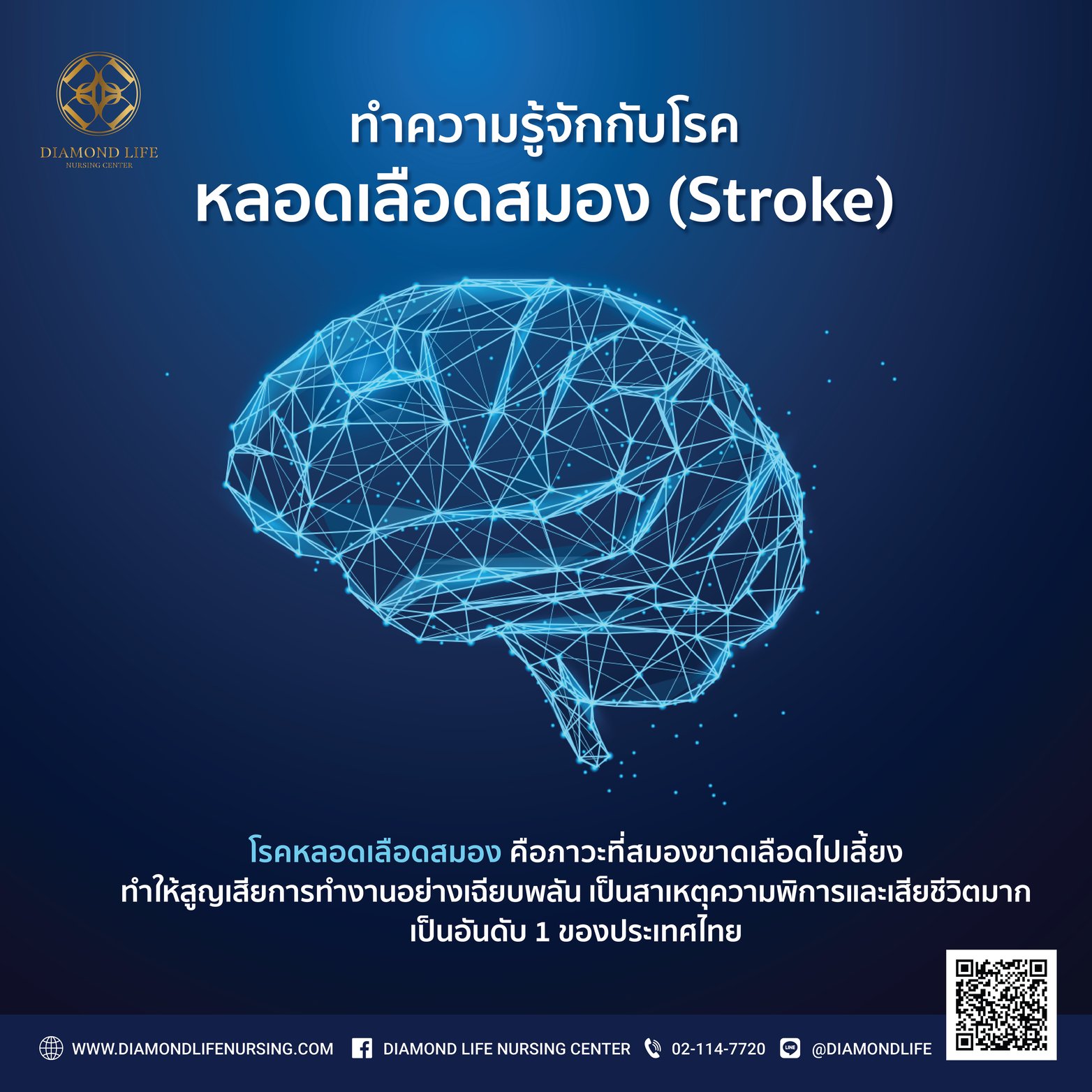 ทำความรู้จักกับโรคหลอดเลือดสมอง (Stroke) 